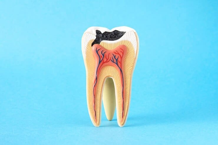 How Can Dental Services In Preventing Tooth Decay?